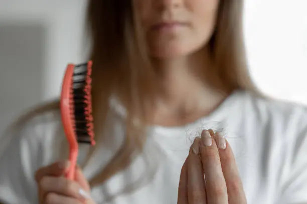 Woman losing hair on hairbrush in hand