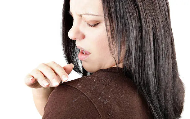 Woman brushing dandruff on her shoulder.